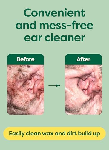 Earth Rated Dog Ear Wipes, Vet Developed, Wild Oat, for Dirt & Wax, 70ct - Image 6